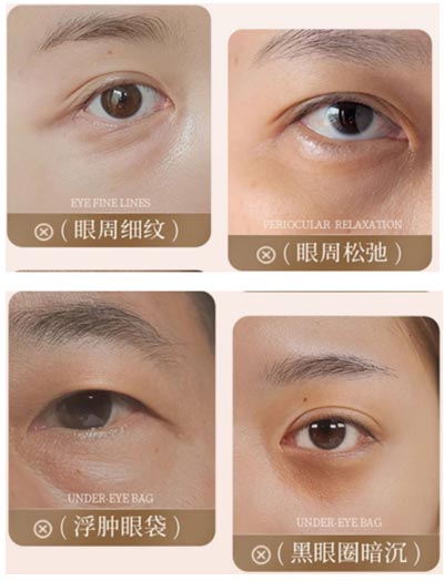 Natural Eye Bag Repair Essence